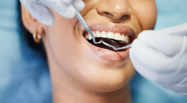 Best Knocked-Out Tooth (Avulsed Tooth) Treatment in Moorhead, MS