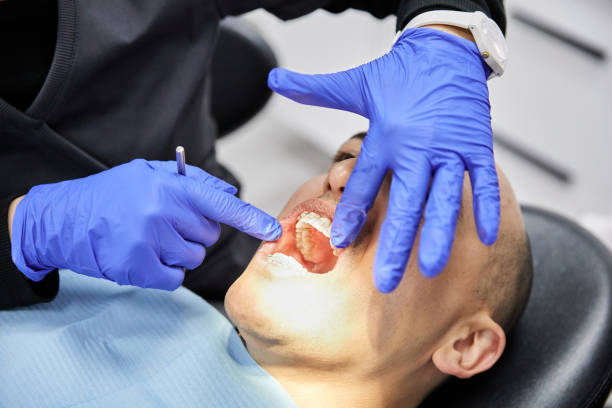 Best Lost Filling or Crown Replacement in Moorhead, MS